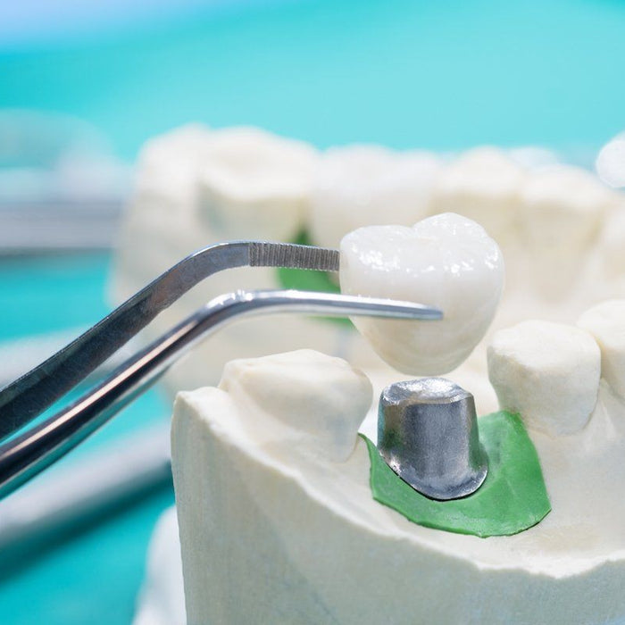 Crown Creation: Tools for Fabricating Dental Crowns